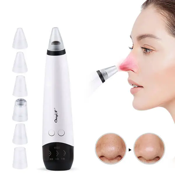All in One Blackhead Remover and Skin Care Solution